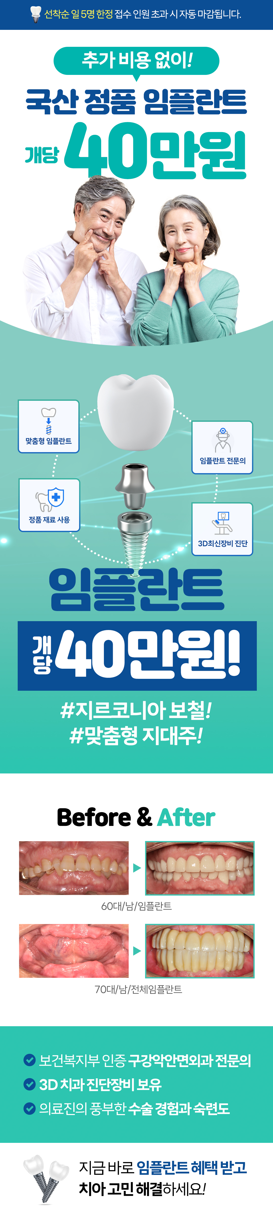 임플란트 할인 이벤트